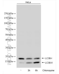 LC3B-Specific Polyclonal antibody proteintech 18725-1-AP