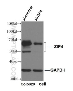 ZIP4 Polyclonal antibody proteintech 20625-1-AP