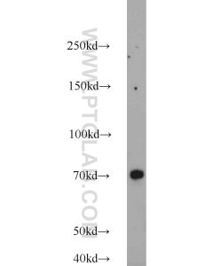 MKS1 Polyclonal antibody proteintech 16206-1-AP