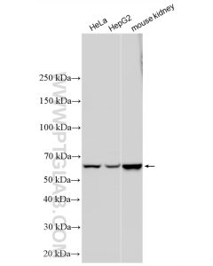 CBS Polyclonal antibody proteintech 14787-1-AP