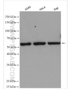 CD138/Syndecan-1 Polyclonal antibody proteintech 10593-1-AP