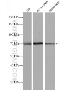SPHK2 Polyclonal antibody proteintech 17096-1-AP