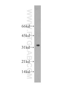 Granzyme B Polyclonal antibody proteintech 13588-1-AP