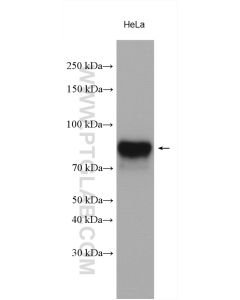 ALPL Polyclonal antibody proteintech 11187-1-AP