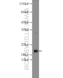 ARL8B Polyclonal antibody proteintech 13049-1-AP