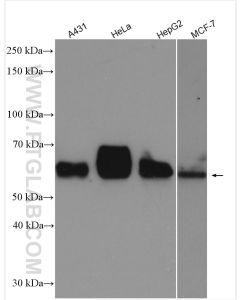 PSAP Polyclonal antibody proteintech 10801-1-AP