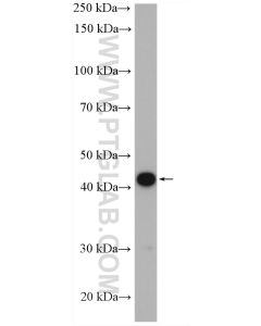 NPHS2 Polyclonal antibody proteintech 20384-1-AP