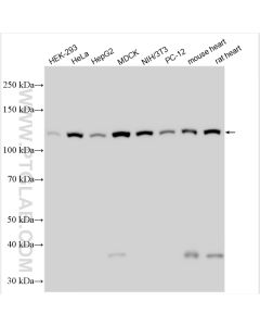 Vinculin Polyclonal antibody proteintech 26520-1-AP