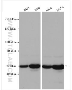 Cytokeratin 8 Polyclonal antibody proteintech 17514-1-AP