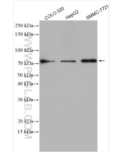 PCSK9 Polyclonal antibody proteintech 55206-1-AP