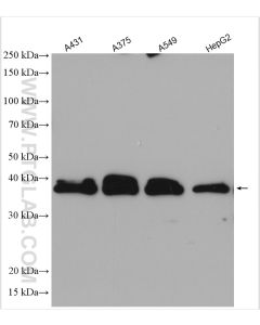 SCD1 Polyclonal antibody proteintech 28678-1-AP