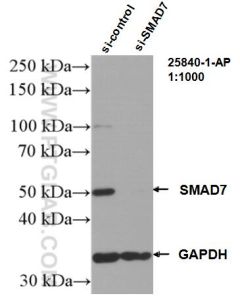 SMAD7 Polyclonal antibody proteintech 25840-1-AP
