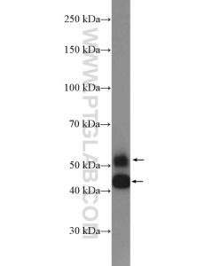JNK Polyclonal antibody proteintech 10023-1-AP