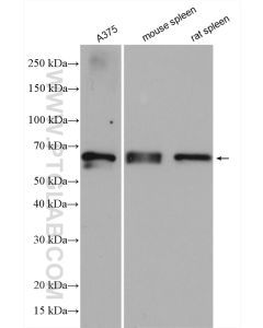 GBP2 Polyclonal antibody proteintech 11854-1-AP