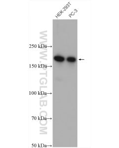 CAMSAP2 Polyclonal antibody proteintech 17880-1-AP