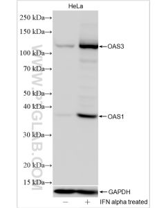 OAS1/3 Polyclonal antibody proteintech 14955-1-AP