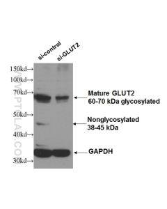 GLUT2 Polyclonal antibody proteintech 20436-1-AP