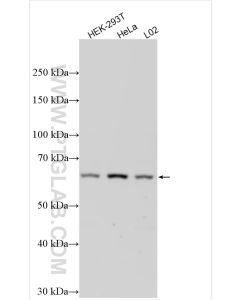 UGT1A10 Polyclonal antibody proteintech 14457-1-AP