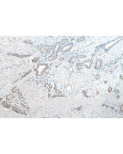 CD47 Polyclonal antibody proteintech 20305-1-AP