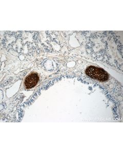 Aggrecan Polyclonal antibody proteintech 13880-1-AP