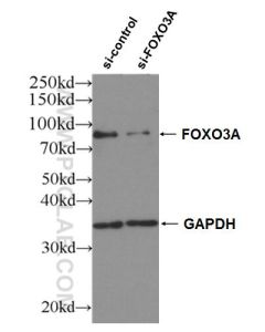 FOXO3A Polyclonal antibody proteintech 10849-1-AP