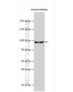 NR3C2 Polyclonal antibody proteintech 21854-1-AP