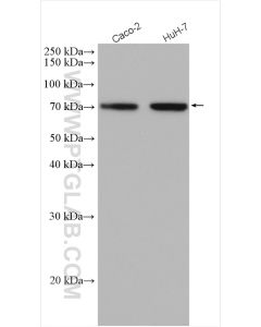 DMT1 Polyclonal antibody proteintech 20507-1-AP