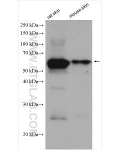 Cytokeratin 1-specific Polyclonal antibody proteintech 16848-1-AP