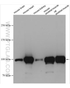 ACTN2 Polyclonal antibody proteintech 14221-1-AP