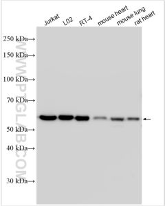 CCDC47 Polyclonal antibody proteintech 32080-1-AP