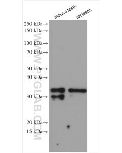 SCP3 Polyclonal antibody proteintech 23024-1-AP