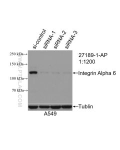 Integrin alpha 6 Polyclonal antibody proteintech 27189-1-AP