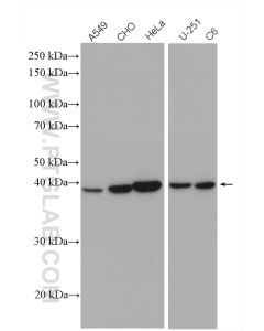 CHAC1 Polyclonal antibody proteintech 15207-1-AP