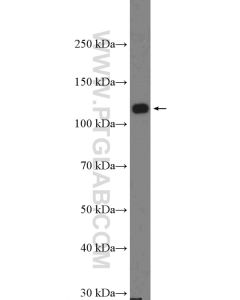 DAAM1 Polyclonal antibody proteintech 14876-1-AP