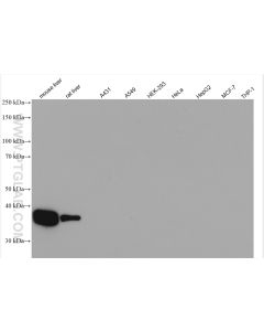Arginase-1 Polyclonal antibody proteintech 16001-1-AP