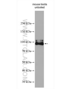 LHCGR Polyclonal antibody proteintech 19968-1-AP