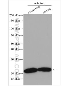 Claudin 5 Polyclonal antibody proteintech 29767-1-AP