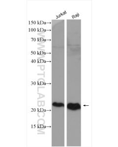 CD81 Polyclonal antibody proteintech 27855-1-AP