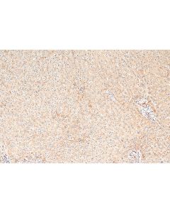 IGF1 Polyclonal antibody proteintech 28530-1-AP