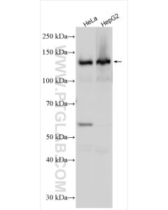 LDLR Polyclonal antibody proteintech 10785-1-AP