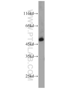 IFT57 Polyclonal antibody proteintech 11083-1-AP