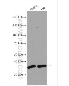JTV1 Polyclonal antibody proteintech 10424-1-AP