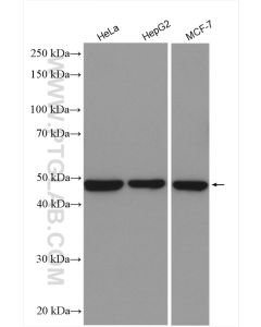 Ribosomal protein L4 Polyclonal antibody proteintech 11302-1-AP