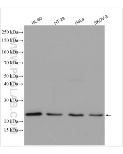 TIMP1 Polyclonal antibody proteintech 16644-1-AP