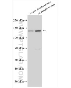 ULK1 Polyclonal antibody proteintech 20986-1-AP