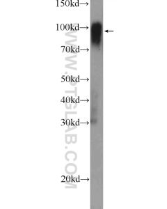 ICAM-1/CD54 Polyclonal antibody proteintech 10020-1-AP