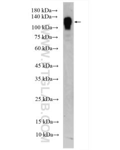 CD31 Polyclonal antibody proteintech 28083-1-AP