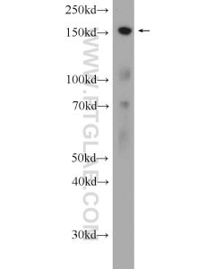 CENPJ Polyclonal antibody proteintech 11517-1-AP
