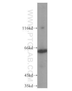 PAK4 Polyclonal antibody proteintech 14685-1-AP
