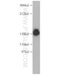 Liprin Alpha 1 Polyclonal antibody proteintech 14175-1-AP